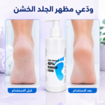 جل مزيل الجلد الميت والكالو 250مل - Image 3